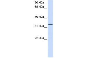 WB Suggested Anti-DOK5 Antibody Titration:  0. (DOK5 Antikörper  (N-Term))