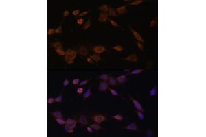Immunofluorescence analysis of NIH-3T3 cells using CYPOR Polyclonal Antibody (ABIN6130227, ABIN6145969, ABIN6145970 and ABIN7101824) at dilution of 1:100 (40x lens). (POR Antikörper  (AA 1-250))