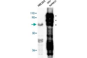 Immunodetection of transfected human TNFRSF21 in HEK 293 cells using TNFRSF21 polyclonal antibody . (TNFRSF21 Antikörper  (AA 372-665))