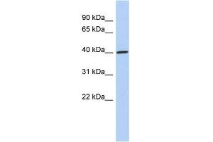 WB Suggested Anti-DDI1 Antibody Titration: 0. (DDI1 Antikörper  (Middle Region))
