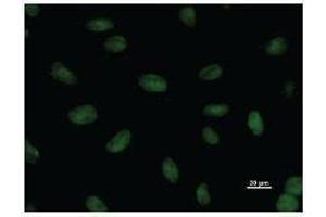 Immunostaining analysis in HeLa cells. (SNAPC1 Antikörper)