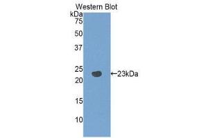 Western Blotting (WB) image for anti-Pannexin 1 (PANX1) (AA 77-260) antibody (ABIN1860124) (PANX1 Antikörper  (AA 77-260))