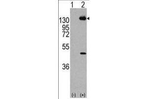 Western blot analysis of PDGFRA (arrow) using rabbit polyclonal PDGFRA Antibody  (R). (PDGFRA Antikörper  (AA 746-775))