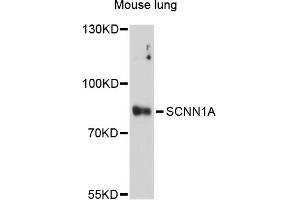Western blot analysis of extracts of mouse lung, using SCNN1A antibody (ABIN5973225) at 1/1000 dilution. (SCNN1A Antikörper)