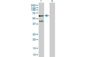 Western Blot analysis of PPARA expression in transfected 293T cell line by PPARA MaxPab polyclonal antibody.