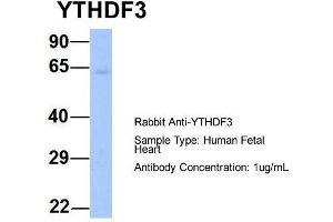 Host: Rabbit  Target Name: YTHDF3  Sample Tissue: Human Fetal Heart  Antibody Dilution: 1. (YTHDF3 Antikörper  (N-Term))