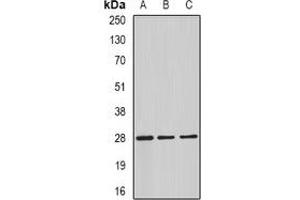 Western blot analysis of C4BP beta expression in HepG2 (A), mouse testis (B), rat testis (C) whole cell lysates. (C4BPB Antikörper)