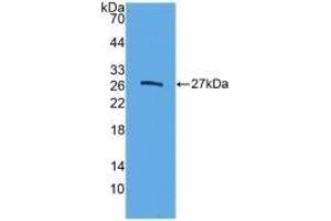 Detection of Recombinant ELA3B, Human using Polyclonal Antibody to Elastase 3B (ELA3B) (Elastase 3B Antikörper  (AA 29-270))