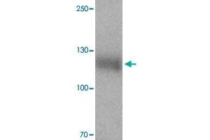 Western blot analysis of LEMD3 in human colon tissue with LEMD3 polyclonal antibody  at 1 ug/mL.