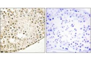 Immunohistochemistry analysis of paraffin-embedded human testis tissue, using SPZ1 Antibody. (SPZ1 Antikörper  (AA 111-160))