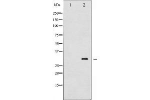 Western blot analysis of TNNI3 phosphorylation expression in Mouse hearttissue lysates,The lane on the left is treated with the antigen-specific peptide. (TNNI3 Antikörper  (pThr143))