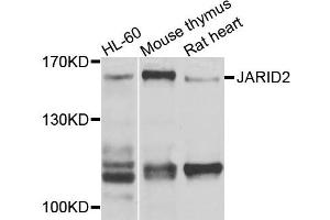 Western blot analysis of extracts of various cells, using JARID2 antibody. (JARID2 Antikörper)