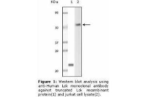 Image no. 1 for anti-Lymphocyte-Specific Protein tyrosine Kinase (LCK) antibody (ABIN232106) (LCK Antikörper)