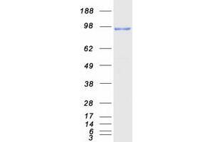Western Blotting (WB) image for Dipeptidylpeptidase 10 (DPP10) (Transcript Variant 1) protein (Myc-DYKDDDDK Tag) (ABIN2719705)