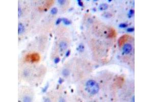 Used in DAB staining on fromalin fixed paraffin-embedded Liver tissue (FAS Antikörper  (AA 188-319))