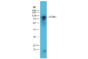 Lane 1: mouse heart lysates probed with Rabbit Anti-VCAM1 Polyclonal Antibody, Unconjugated  at 1:5000 for 90 min at 37˚C. (VCAM1 Antikörper  (AA 651-739))