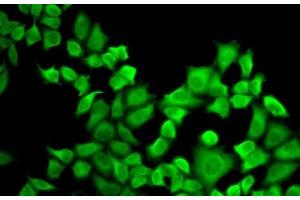 Immunofluorescence analysis of A-549 cells using DHFR Polyclonal Antibody (Dihydrofolate Reductase Antikörper)