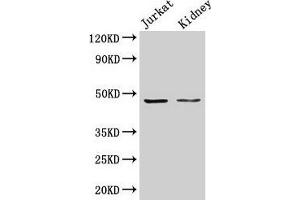 Western Blot Positive WB detected in: Jurkat whole cell lysate, Rat kidney tissue All lanes: ALDOA antibody at 3 μg/mL Secondary Goat polyclonal to rabbit IgG at 1/50000 dilution Predicted band size: 40, 46 kDa Observed band size: 46 kDa (ALDOA Antikörper  (AA 2-364))