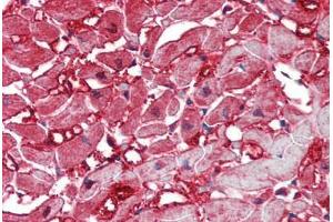 Human Heart: Formalin-Fixed, Paraffin-Embedded (FFPE)