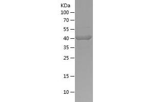 Western Blotting (WB) image for Myosin Heavy Chain 4, Skeletal Muscle (MYH4) (AA 145-329) protein (His-IF2DI Tag) (ABIN7282518) (MYH4 Protein (AA 145-329) (His-IF2DI Tag))