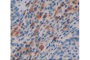 IHC-P analysis of Human Tissue, with DAB staining. (FBLN4 Antikörper  (AA 136-225))