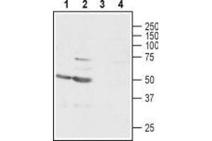Western blot analysis of rat (lanes 1 and 3) and mouse (lanes 2 and 4) brain lysates: - 1,2. (GABRg1 Antikörper  (C-Term, Intracellular))