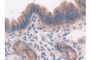 Immunohistochemistry (IHC) image for anti-Protein tyrosine Phosphatase, Receptor Type, J (PTPRJ) (AA 567-842) antibody (ABIN7441778)