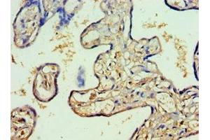 Immunohistochemistry of paraffin-embedded human placenta tissue using ABIN7150384 at dilution of 1:100 (RFX5 Antikörper  (AA 367-616))