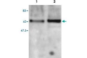 Western blot was performed on nuclear extracts from mouse fibroblastst (NIH/3T3) and embryonic stem cells (E14Tg2a) with Mbd2 polyclonal antibody , diluted 1 : 500 in BSA/PBS-Tween.