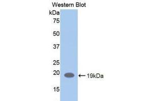 Western blot analysis of the recombinant protein. (LIFR Antikörper  (AA 692-833))