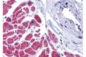Immunohistochemistry of caspase-12 in human heart tissue with caspase-12 antibody at 10 μg/ml. (Caspase 12 Antikörper  (N-Term))