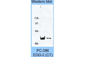 Image no. 1 for anti-Lysophosphatidic Acid Receptor 1 (LPAR1) (C-Term) antibody (ABIN187787) (LPAR1 Antikörper  (C-Term))