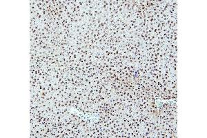 IHC analysis of PTBP2 using anti-PTBP2 antibody (ABIN7599452).