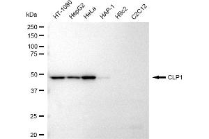 Western blotting analysis using CLP1 antibody (ABIN7798094). (Rekombinanter CLP1 Antikörper)