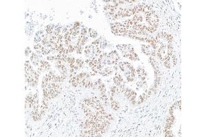 anti-Structural Maintenance of Chromosomes 1A (SMC1A) (C-Term) antibody