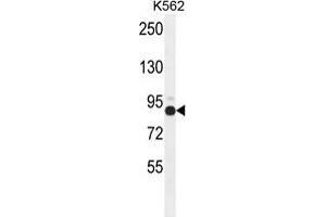 ZNF366 Antibody (C-term) western blot analysis in K562 cell line lysates (35 µg/lane). (ZNF366 Antikörper  (C-Term))