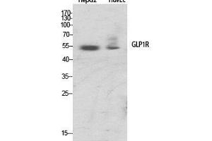 Western Blot (WB) analysis of specific cells using GLP-1R Polyclonal Antibody. (GLP1R Antikörper  (Internal Region))