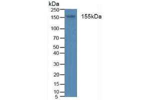 Detection of INSR in Human Blood Cells using Polyclonal Antibody to Insulin Receptor (INSR) (Insulin Receptor Antikörper  (AA 1024-1298))