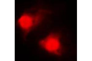 Immunofluorescent analysis of RAR beta staining in MDAMB435 cells. (Retinoic Acid Receptor beta Antikörper  (C-Term))