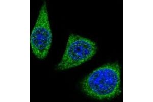 Immunofluorescence (IF) image for anti-Matrix Metallopeptidase 7 (Matrilysin, Uterine) (MMP7) (AA 117-146) antibody (ABIN3031723)