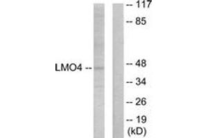 Western Blotting (WB) image for anti-LIM Domain Only 4 (LMO4) (AA 116-165) antibody (ABIN2889531) (LMO4 Antikörper  (AA 116-165))
