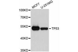 Western blot analysis of extracts of various cell lines, using TP53 antibody.