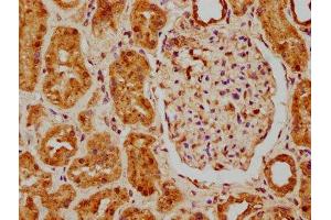 IHC image of ABIN7159929 diluted at 1:200 and staining in paraffin-embedded human kidney tissue performed on a Leica BondTM system. (MSRA Antikörper  (AA 24-235))