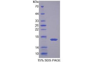 SDS-PAGE analysis of Cow FABP2 Protein. (FABP2 Protein)