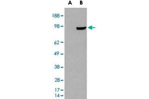 HEK293 overexpressing PDE5A and probed with PDE5A polyclonal antibody  (mock transfection in first lane), tested by Origene.