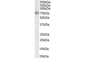 ABIN184623 staining (0. (MTA1 Antikörper  (Internal Region))