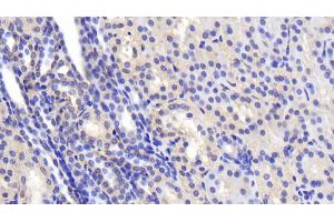 Detection of SPTAN1 in Human Kidney Tissue using Polyclonal Antibody to Alpha-Fodrin (SPTAN1) (SPTAN1 Antikörper  (AA 1573-1742))