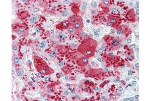 Anti-CDCP1 antibody IHC of human liver. (CDCP1 Antikörper  (Internal Region))