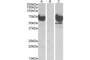 HEK293 lysate (10ug protein in RIPA buffer) overexpressing Human EPM2AIP1 with DYKDDDDK tag probed with ABIN5539636 (1ug/ml) in Lane A and probed with anti-DYKDDDDK Tag (1/1000) in lane C. (EPM2AIP1 Antikörper  (Internal Region))