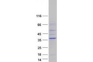 Western Blotting (WB) image for Neuralized Homolog 2 (NEURL2) protein (Myc-DYKDDDDK Tag) (ABIN2727119)